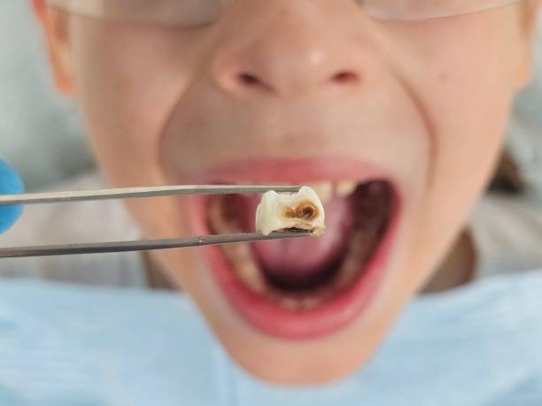 Best Emergency Dentist for Special Needs Patients in Benton, IL